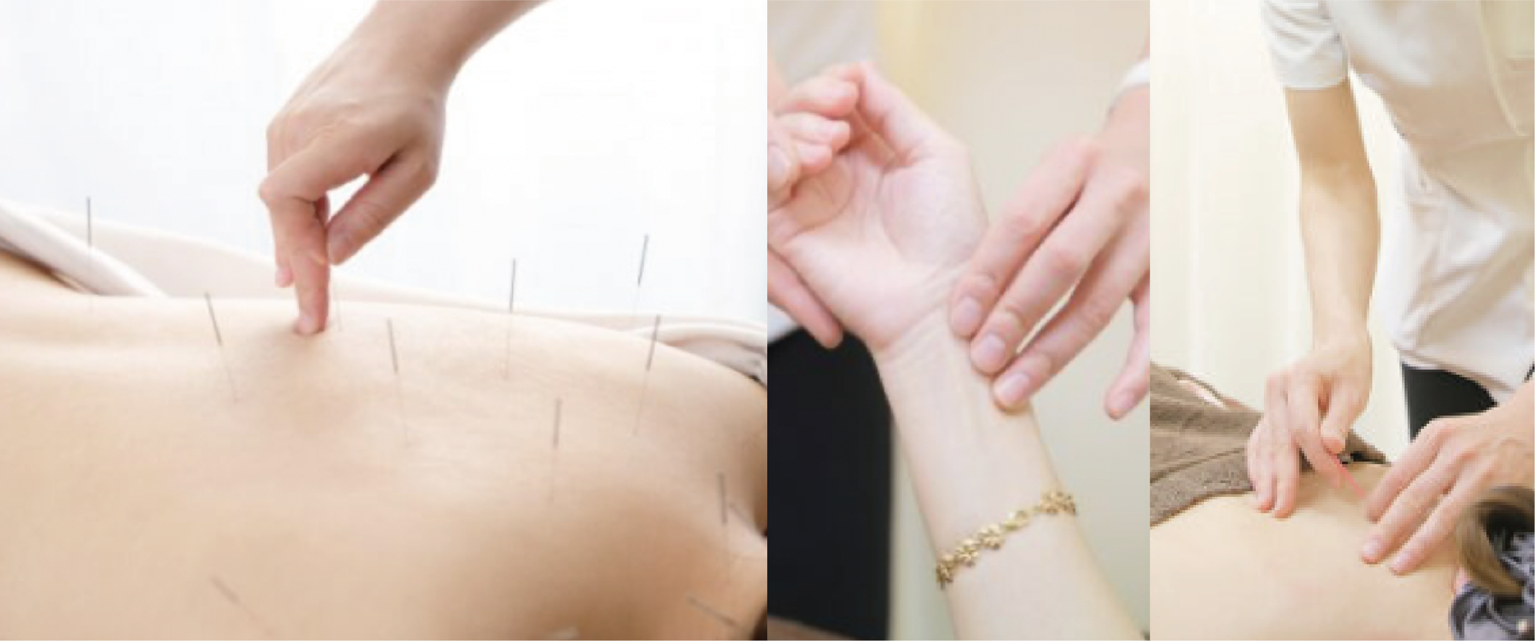 東洋医学 マチコ鍼灸 MACHIKO SHINKYU